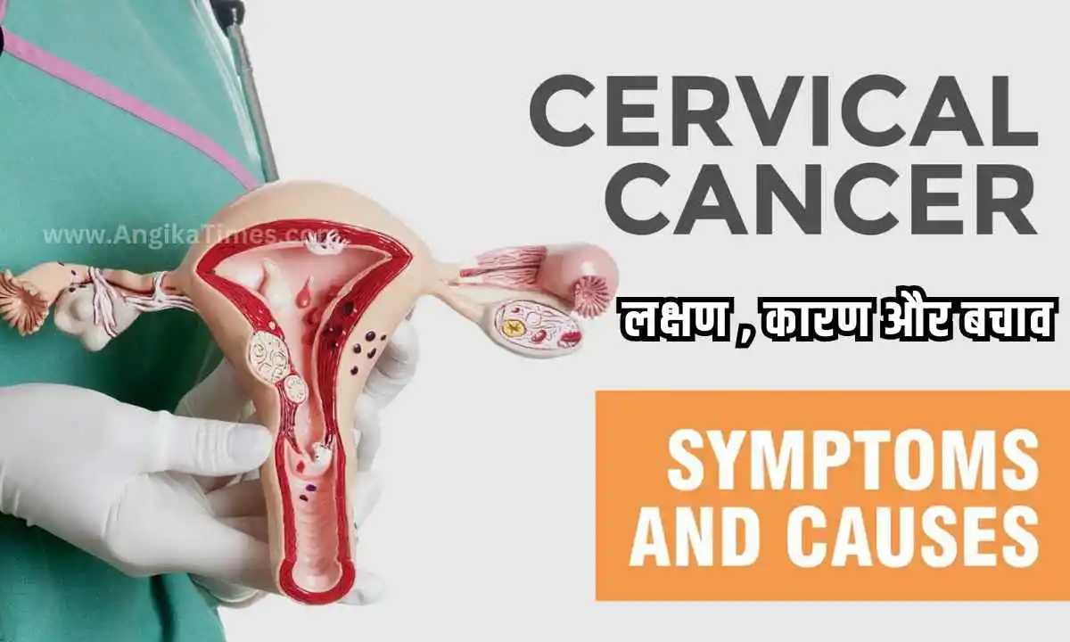 Cervical cancer